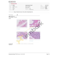 Pathology report - lung. Dealer was raised by one of the breeders (smokers) until he was 7months. In 2013 he was first evaluated for a cough. Allergies suspected. Seasonal sensitivity. at 12 & 13 years old the full impact was felt. Lung disease was his primary problem. 