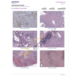 Liver Biopsy Report 2-20-23 pg.4