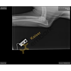 OFA X-ray elbow R