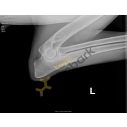 Left Elbow X-rays 