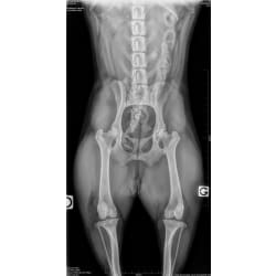 x-rays of hips