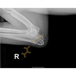 OFA Right Elbow X-ray 