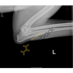 OFA Left Elbow X-ray 