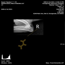 right elbow x-rays